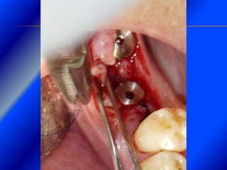 Clase Conexiones 2008 Alumn