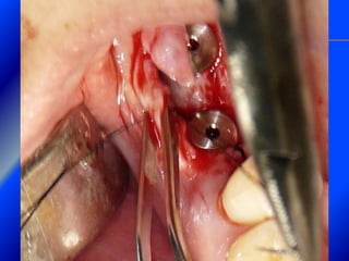 Clase Conexiones 2008 Alumn