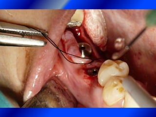 Clase Conexiones 2008 Alumn