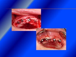 Clase Conexiones 2008 Alumn