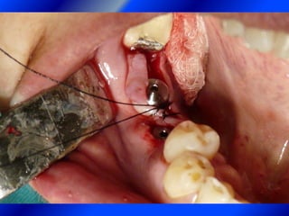 Clase Conexiones 2008 Alumn