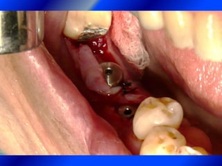 Clase Conexiones 2008 Alumn