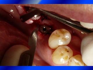 Clase Conexiones 2008 Alumn