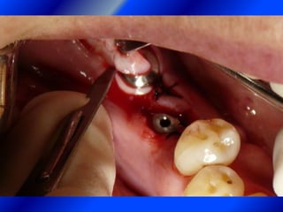 Clase Conexiones 2008 Alumn