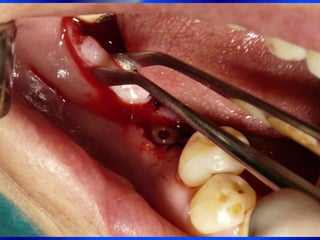 Clase Conexiones 2008 Alumn