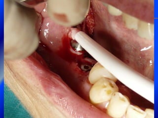 Clase Conexiones 2008 Alumn