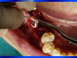 Clase Conexiones 2008 Alumn