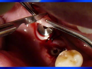 Clase Conexiones 2008 Alumn