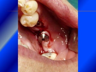 Clase Conexiones 2008 Alumn