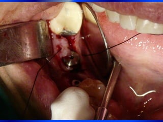 Clase Conexiones 2008 Alumn