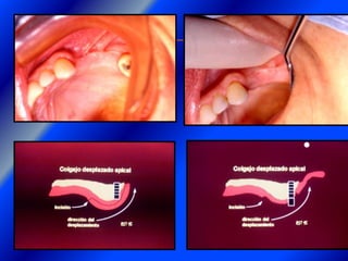 Clase Conexiones 2008 Alumn