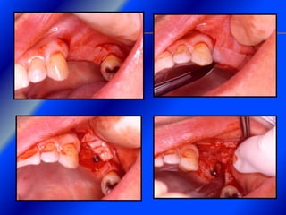 Clase Conexiones 2008 Alumn