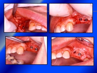 Clase Conexiones 2008 Alumn