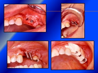 Clase Conexiones 2008 Alumn