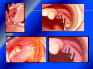 Clase Conexiones 2008 Alumn