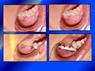 Clase Conexiones 2008 Alumn