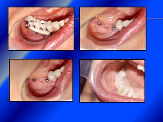 Clase Conexiones 2008 Alumn