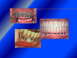 Clase Conexiones 2008 Alumn