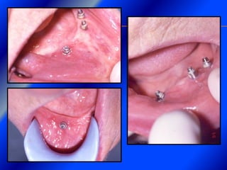 Clase Conexiones 2008 Alumn