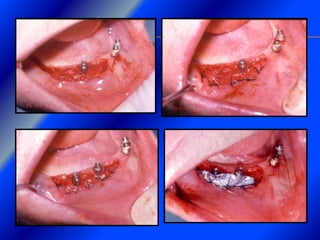 Clase Conexiones 2008 Alumn