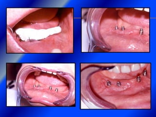 Clase Conexiones 2008 Alumn