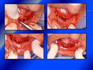 Clase Conexiones 2008 Alumn