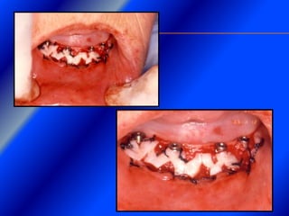 Clase Conexiones 2008 Alumn