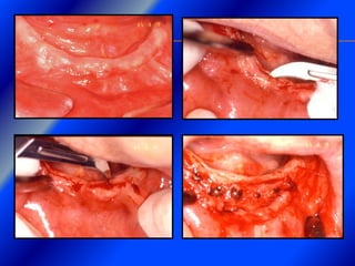 Clase Conexiones 2008 Alumn