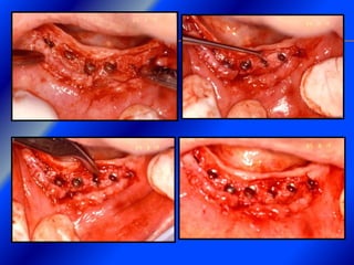 Clase Conexiones 2008 Alumn