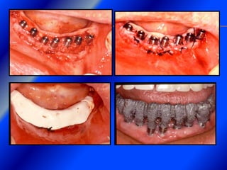 Clase Conexiones 2008 Alumn