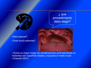 Clase Conexiones 2008 Alumn