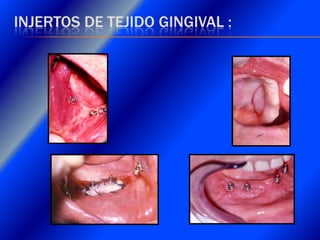 Clase Conexiones 2008 Alumn