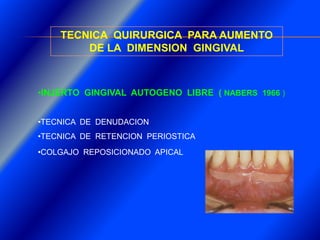 Clase Conexiones 2008 Alumn