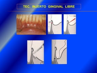 Clase Conexiones 2008 Alumn
