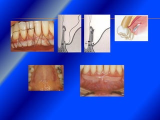 Clase Conexiones 2008 Alumn