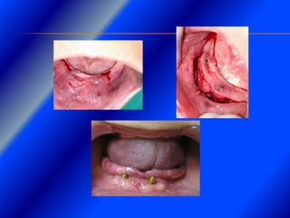 Clase Conexiones 2008 Alumn