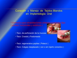 Clase Conexiones 2008 Alumn