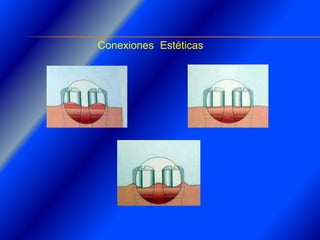 Clase Conexiones 2008 Alumn