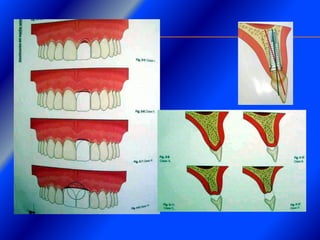 Clase Conexiones 2008 Alumn