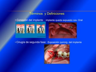 Clase Conexiones 2008 Alumn