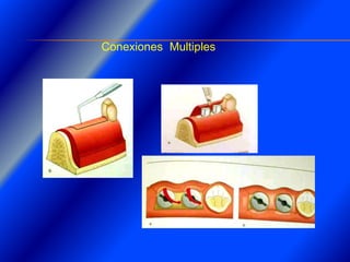 Clase Conexiones 2008 Alumn