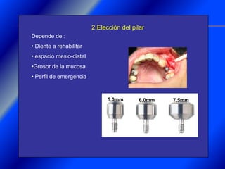 Clase Conexiones 2008 Alumn