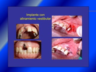 Clase Conexiones 2008 Alumn