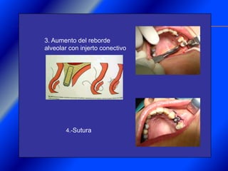 Clase Conexiones 2008 Alumn