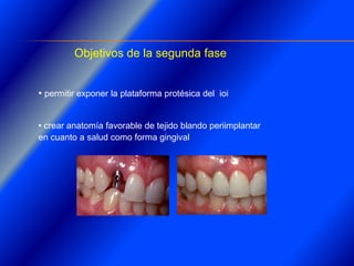 Clase Conexiones 2008 Alumn