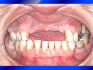 Clase Conexiones 2008 Alumn