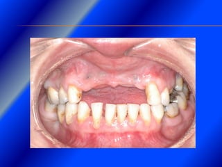 Clase Conexiones 2008 Alumn