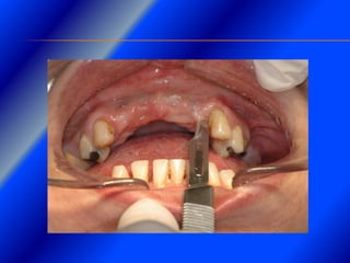 Clase Conexiones 2008 Alumn