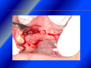 Clase Conexiones 2008 Alumn