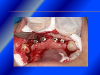 Clase Conexiones 2008 Alumn